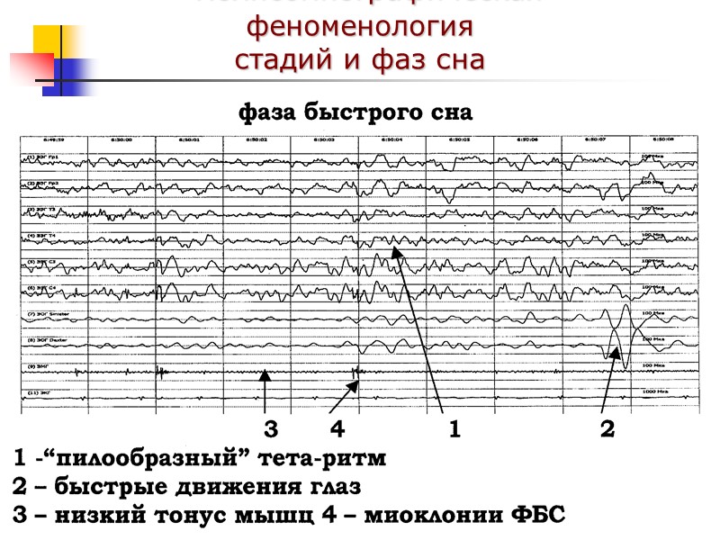 Полисомнографическая феноменология стадий и фаз сна